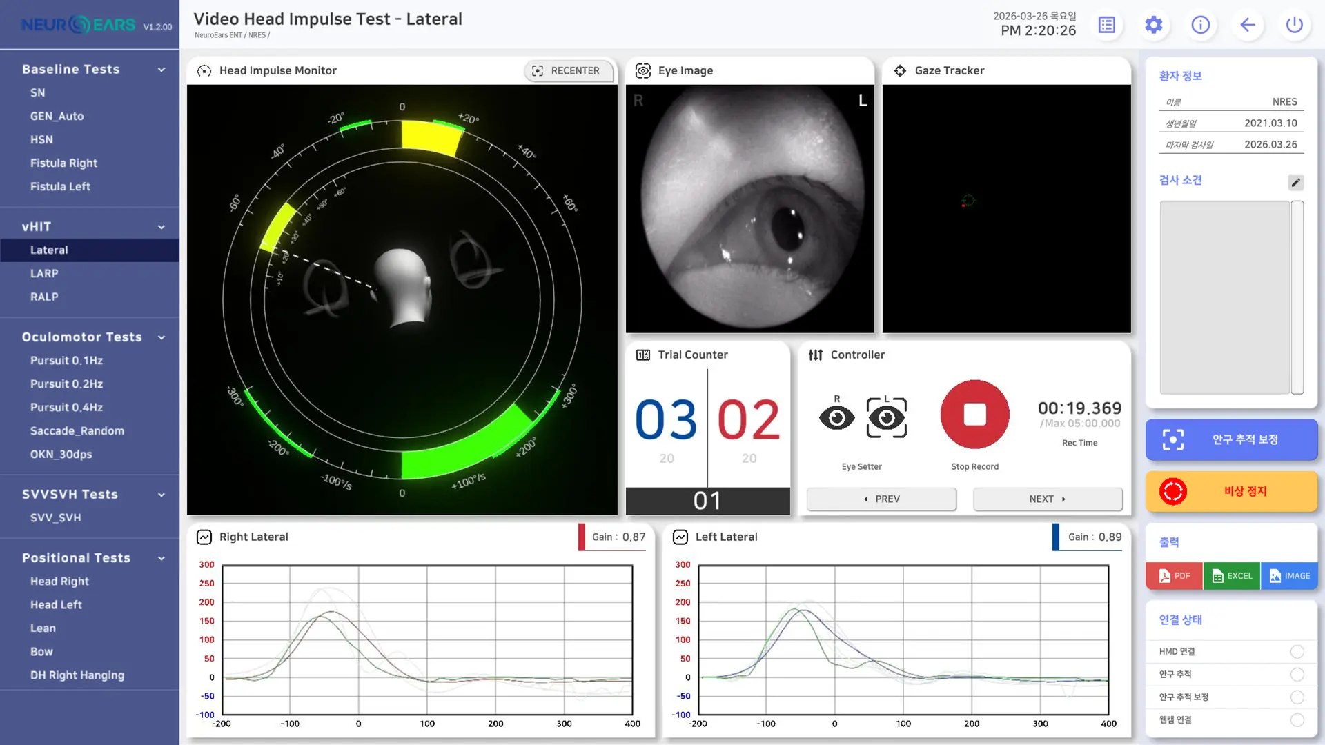 뉴로이어즈 어지럼 검사 프로그램 화면